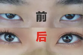 男生3分钟教你贴双眼皮！视频封面