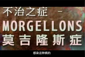 2001年美国男孩伤口长纤维，医生认为是幻觉，母亲却发现多人如此视频封面