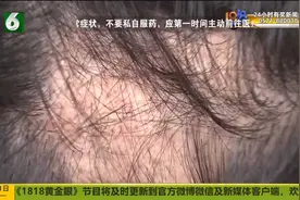 拆东墙补西墙 东墙要等“春天”？视频封面