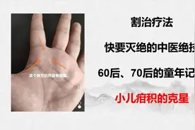 60后、70后、80后的童年记忆——割治疗法——小儿疳积证的克星！视频封面