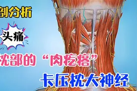 偏头痛？后脑勺疼痛？可能是枕大神经卡压，推拿按摩时需注意！视频封面
