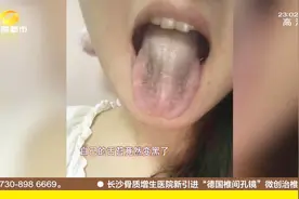 女孩舌苔“突然发黑”，医生：长期熬夜导致肾严重透支！视频封面