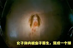 女子体内被虫子寄生，涨成一个球！视频封面