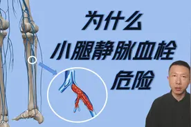 小腿静脉血栓形成的危险因素以及如何预防（6条生活建议）视频封面
