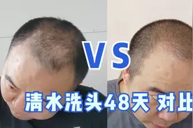 挑战100天清水洗头，第48天头发变多，发质变好，后悔没早点用视频封面