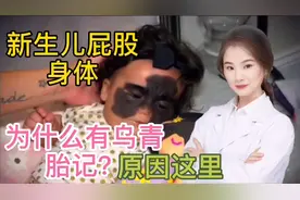 新生儿身体和臀部 为什么有这么多乌青或者胎记？原因多种 看完视频封面