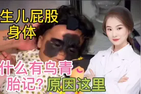 新生儿身体和臀部 为什么有这么多乌青或者胎记？原因多种 看完视频封面