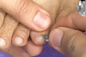 修理脚趾甲视频封面