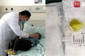 危险！奶奶喂2岁孙子毛豆致右肺堵塞 医生：3岁以下最好不喂豆类视频封面