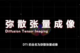 警惕脑海中的“橡皮擦”。DTI技术有利于疾病的早识别和早诊断视频封面