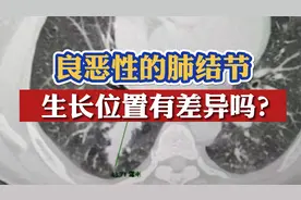 肺结节长在哪里最危险？医生坦言：位置不是评判危险性的主要指标视频封面