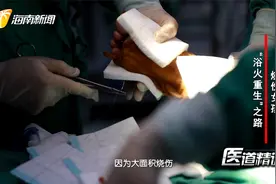 《医道精诚》丨烧伤女孩的“浴火重生”之路视频封面