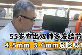 查出双肺多发结节，比较小都是4-5mm，不危险可继续观察视频封面