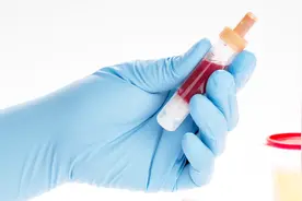 肾结石尿血怎么回事？应该怎么治？医生主讲这种疗法！视频封面