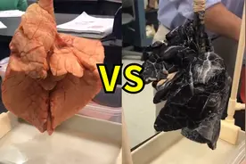 太直观！国外一则假肺对比走红，健康的肺对比抽烟人士的肺视频封面