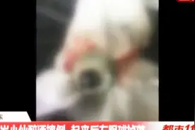 没救！26岁小伙醉酒摔倒,起来后左眼球掉落!几小时后家人捡回来了视频封面