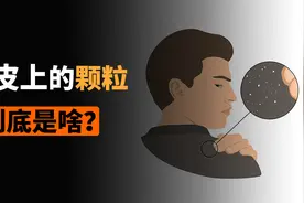 头皮上抠下来的小颗粒，到底是啥？视频封面