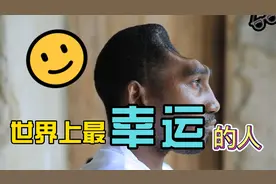 他是世界上最幸运的人，经历事故，最后坚强的活了下来视频封面