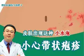 当疼痛部位出现成片的小疱疹时，医生建议您，要考虑到是带状疱疹视频封面