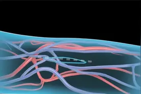 3D医学动画：血液透析过程