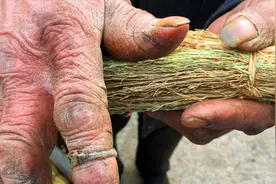 手上有老茧怎么办？教你用一秘招，轻松去除茧子，有效又简单