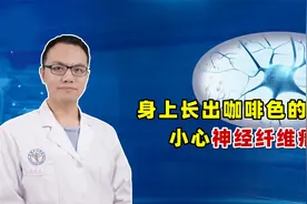 神经科医生忠告：身上长出这种咖啡色的斑点，留心神经纤维瘤视频封面