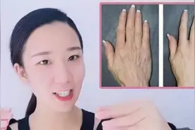 手指皱巴巴，黑黄好显老！1套手指逆龄按摩操，手细腻白嫩不显老视频封面