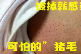 儿子长出“猪毛”哭闹不停, 妈妈直接拔掉, 导致孩子不幸夭折视频封面