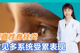 眼睛反复发红、充血、疼痛，可不一定是眼病，当心强直性脊柱炎！视频封面
