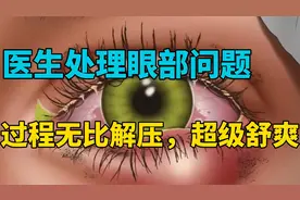 美女去医院处理眼部问题，过程超级舒爽，非常解压视频封面