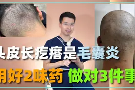 头皮上长疙瘩，那是毛囊炎！做对3件事，用好3味药，消炎好得快视频封面