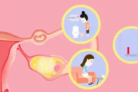 一般情况下，宫外孕约在孕后6到8周破裂，要注意这些症状表现视频封面