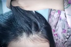 【助眠】头皮屑清洁和头皮按摩吃饭必看视频封面