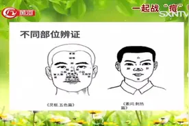 专家来了：专家分析脸上长痘痘的原因，这些不良习惯你有吗？视频封面