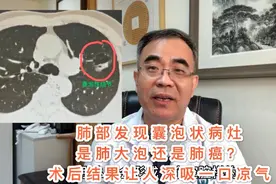 肺部发现囊泡状病灶，是肺大泡还是肺癌？术后感叹，幸好做了手术视频封面