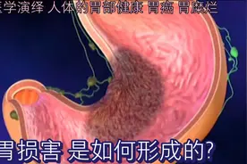 医学演绎 人体的胃部健康 胃癌 胃糜烂 胃损害 是如何形成的？