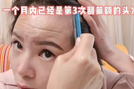 一个月内已经是第3次刮前额细绒头发了,期待着它能长粗长密一点