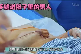 大受震撼！男子手臂烧伤面临截肢，医生：把手缝进肚子里，养一养视频封面