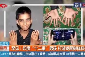 罕见！印度“十二指”男孩不自卑，利用“优势”打游戏爬树样样行视频封面