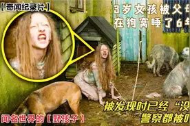 她3岁被父母抛弃，在狗窝睡了6年，被发现时的举动吓坏众人视频封面