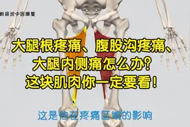 大腿根疼痛、腹股沟疼痛、大腿内侧痛怎么办？这块肌肉你一定要看视频封面