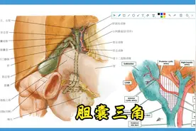 腹部：胆囊三角视频封面
