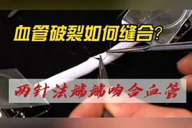 血管破裂如何缝合？| 两针法端端吻合血管视频封面