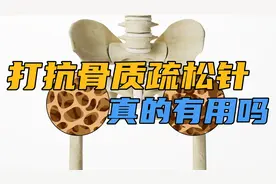 骨密度-4，医生建议打抗骨质疏松针，请问这种针真的有用吗？视频封面