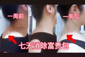 一周见效，这样锻炼富贵包，一个月富贵包就没有了视频封面