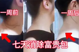一周见效，这样锻炼富贵包，一个月富贵包就没有了视频封面