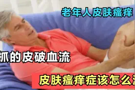 老年人晚上睡觉浑身瘙痒，到底是怎么回事？医生教你正确应对法门视频封面