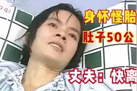 29岁女子怀怪胎，3年还没生，50公斤巨腹让医生都害怕，纪录片视频封面