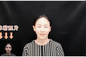 烟台华美整形外科医院双眼皮医生推荐#整形前整形后##整形胸部视频封面