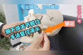 颞下颌关节为什么会脱位，如何复位，沈医生为你讲解，手法演示。视频封面